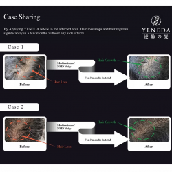 YENEDA - NMN15000+ 逆齡の髮 60粒裝 YENEDA - NMN15000+ 逆齡の髮 60粒裝
