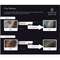 YENEDA - NMN15000+ 逆齡の髮 60粒裝